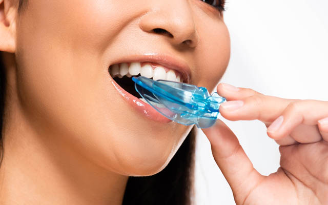 woman inserting dental mouth guard